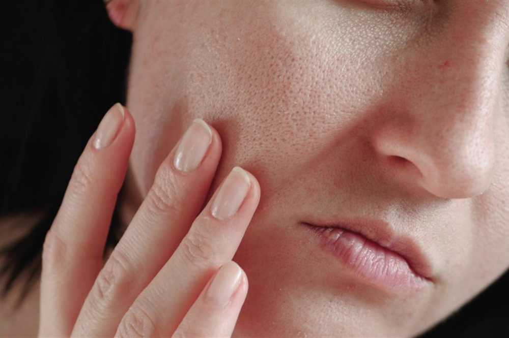 5 وصفات طبيعية تخلصك من مشكلة المسام الواسعة المزعجة