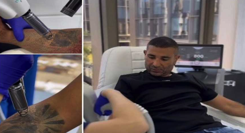 فيديو إزالة وشم أحمد سعد يتصدر الترند، والمطرب: أنا مش ضد التاتو